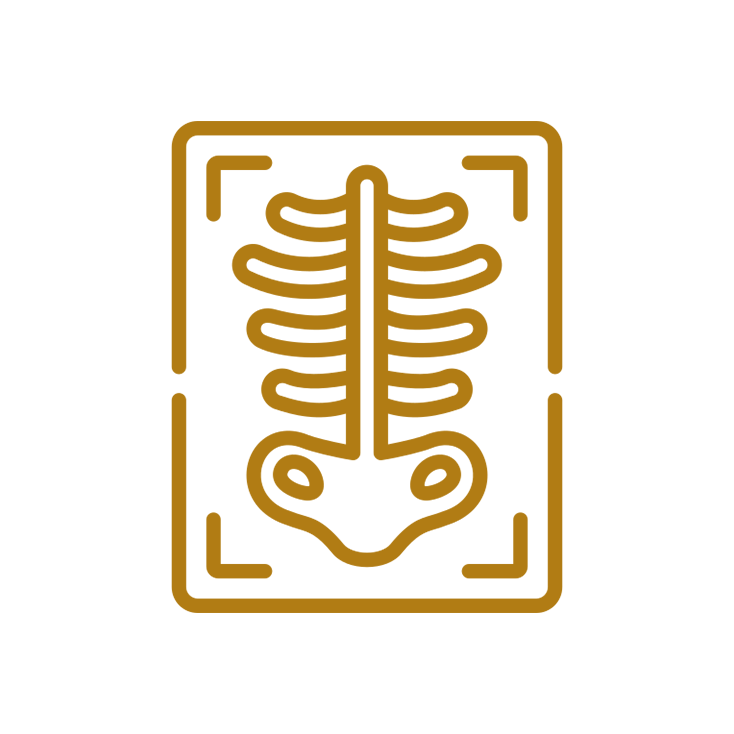 X-Ray