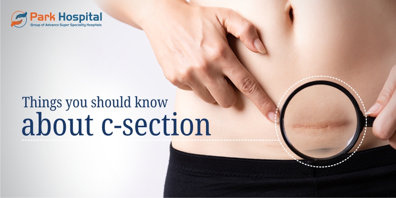 Things you should know about C-Section