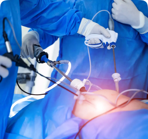 Laparoscopic Surgery
